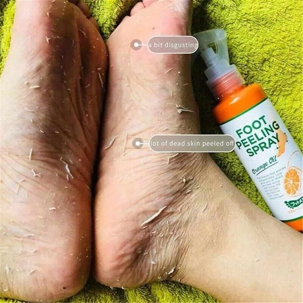 مقشر القدم  foot peeling 110ml